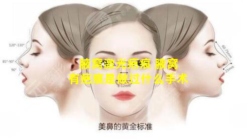 腋窝激光疤痕 腋窝有疤痕是做过什么手术